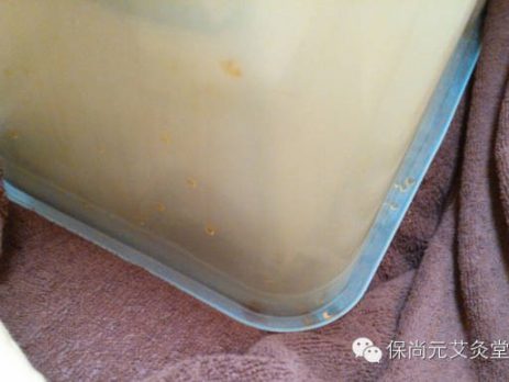 保尚元艾灸堂调理案例